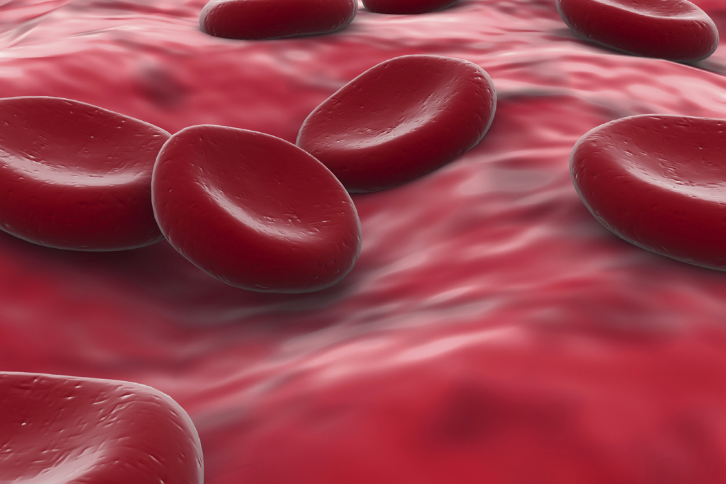 Blood Clot Disorders: 5 simple but critical tips for prevention - Care Club